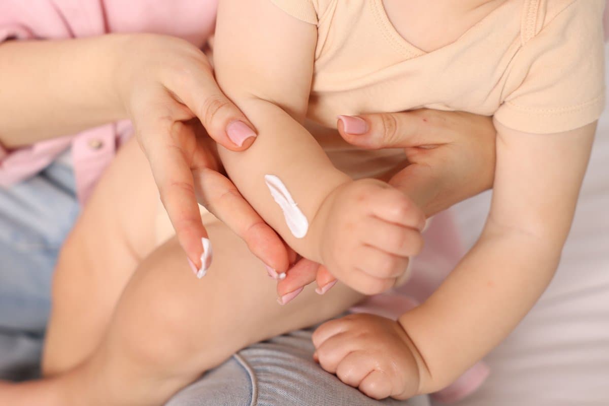 Consideraciones Especiales: Eczema en Bebés, Niños y Adultos