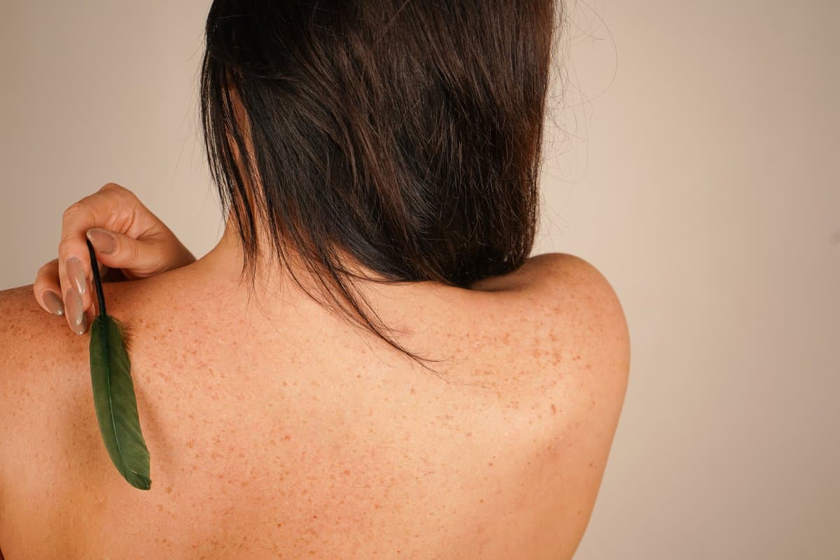 ¿Cuero cabelludo con picazón? 10 razones por las que tu cabeza no deja de picar