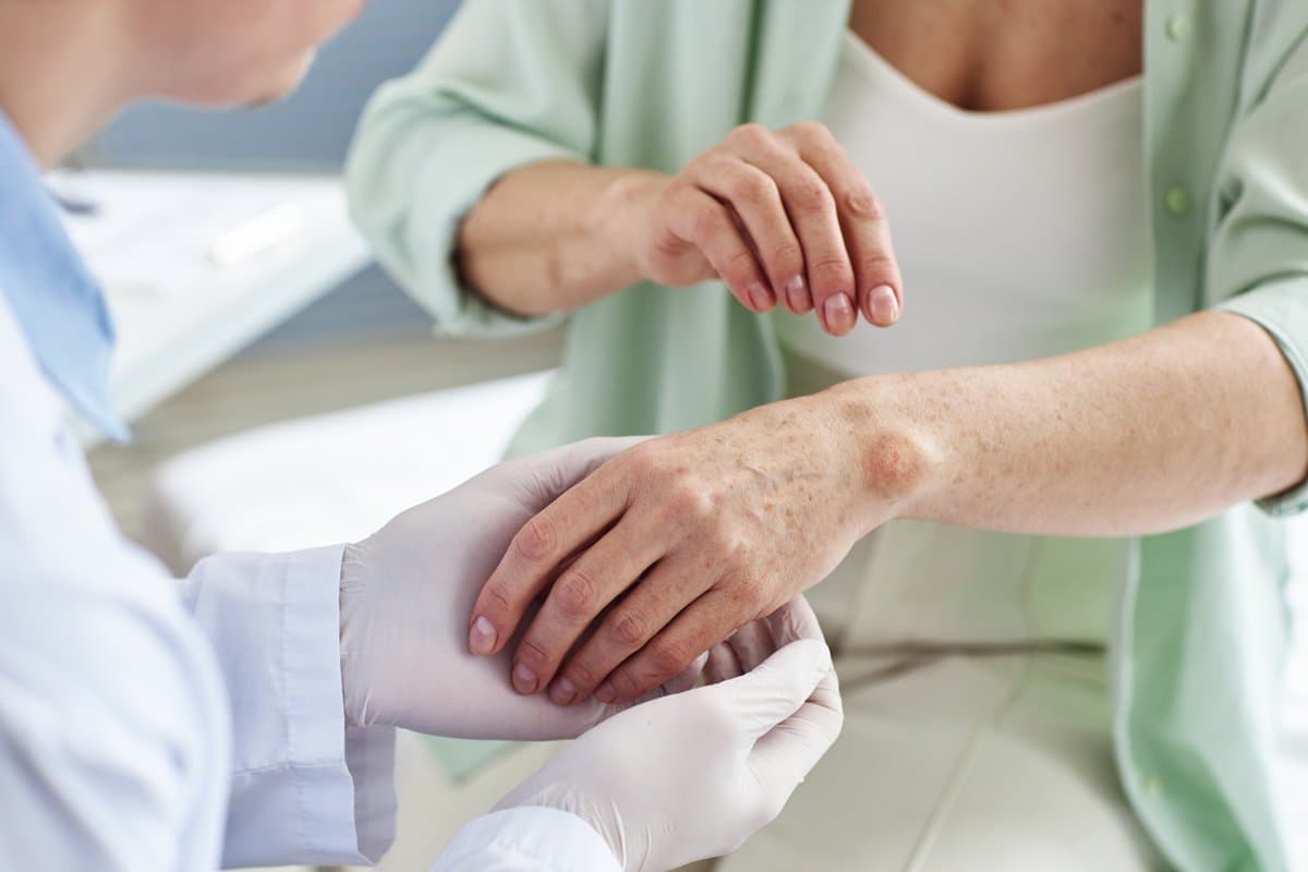 How AI Skin Analysis Can Help Identify Contact Dermatitis