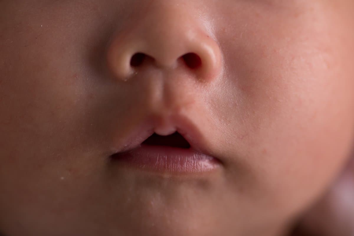 Lo que Realmente Significan los Poros Grandes (Y Cómo Minimizar su Apariencia)