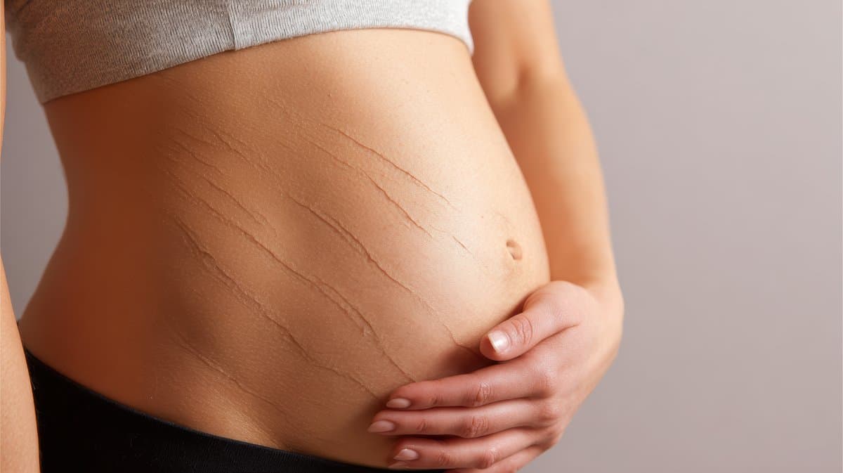 Infección por Estafilococos en la Piel: Cómo se Ve y Tratamiento