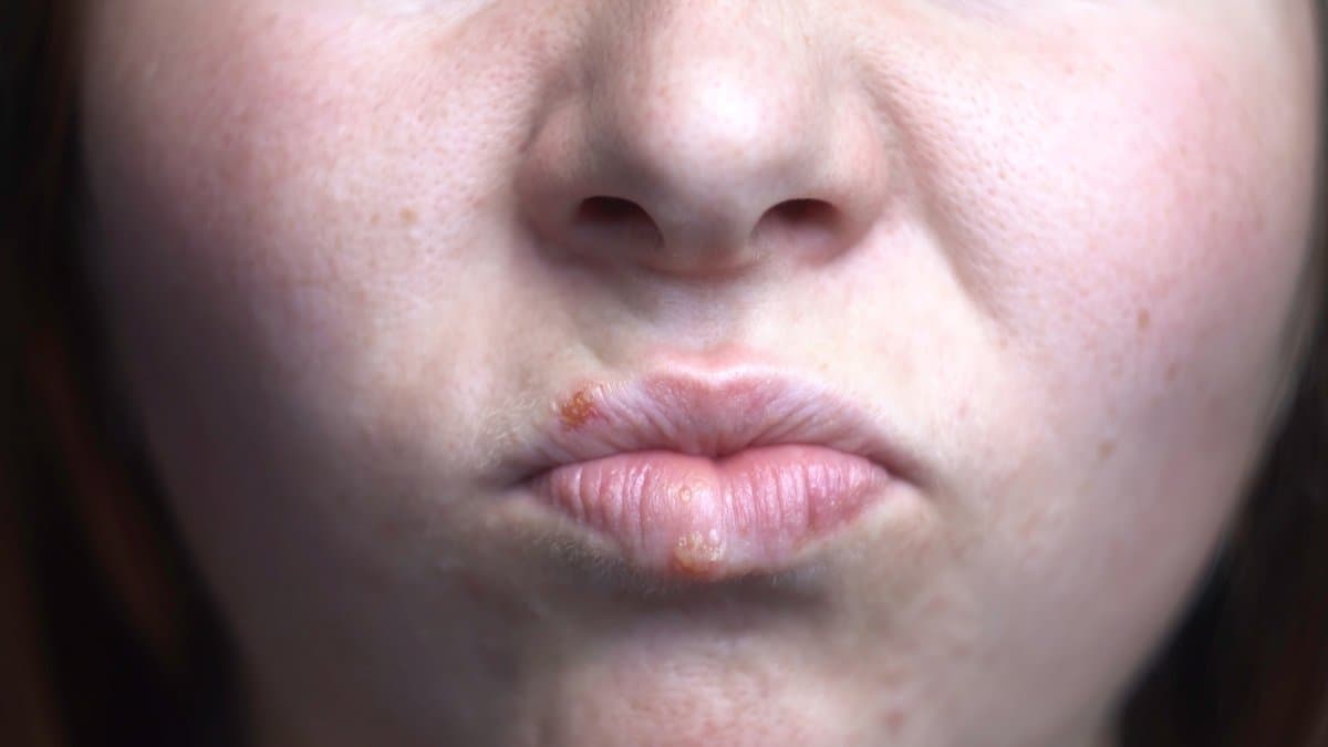 Textura de la Piel Explicada: Protuberancias, Aspereza y Tono Desigual