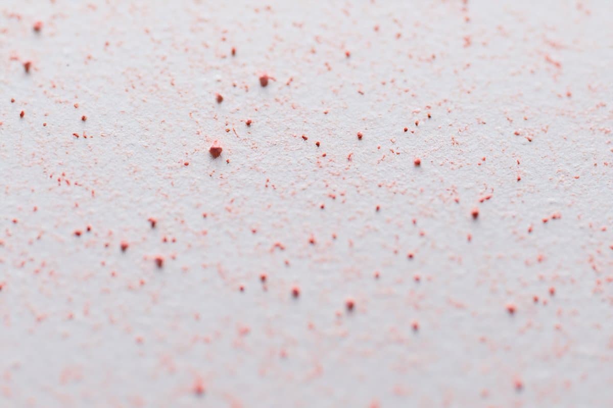 Tiña vs Eccema: Cómo Diferenciarlos