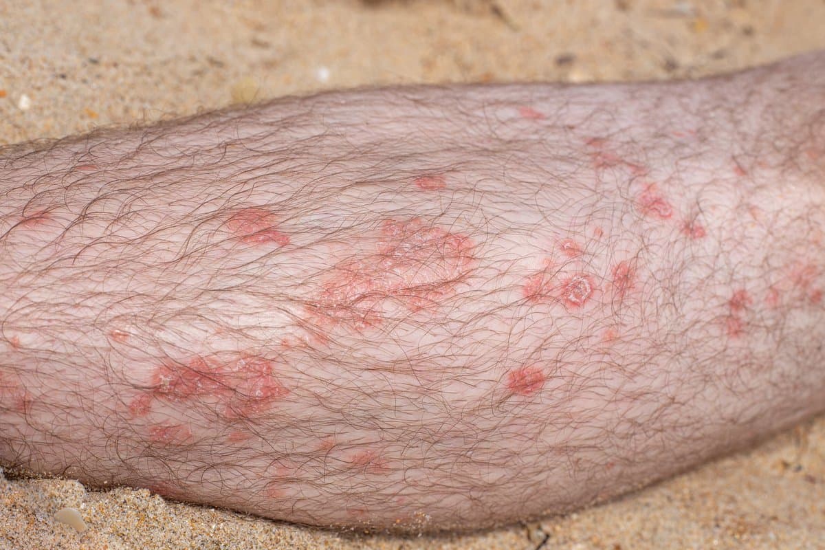 Appearance and Symptoms
