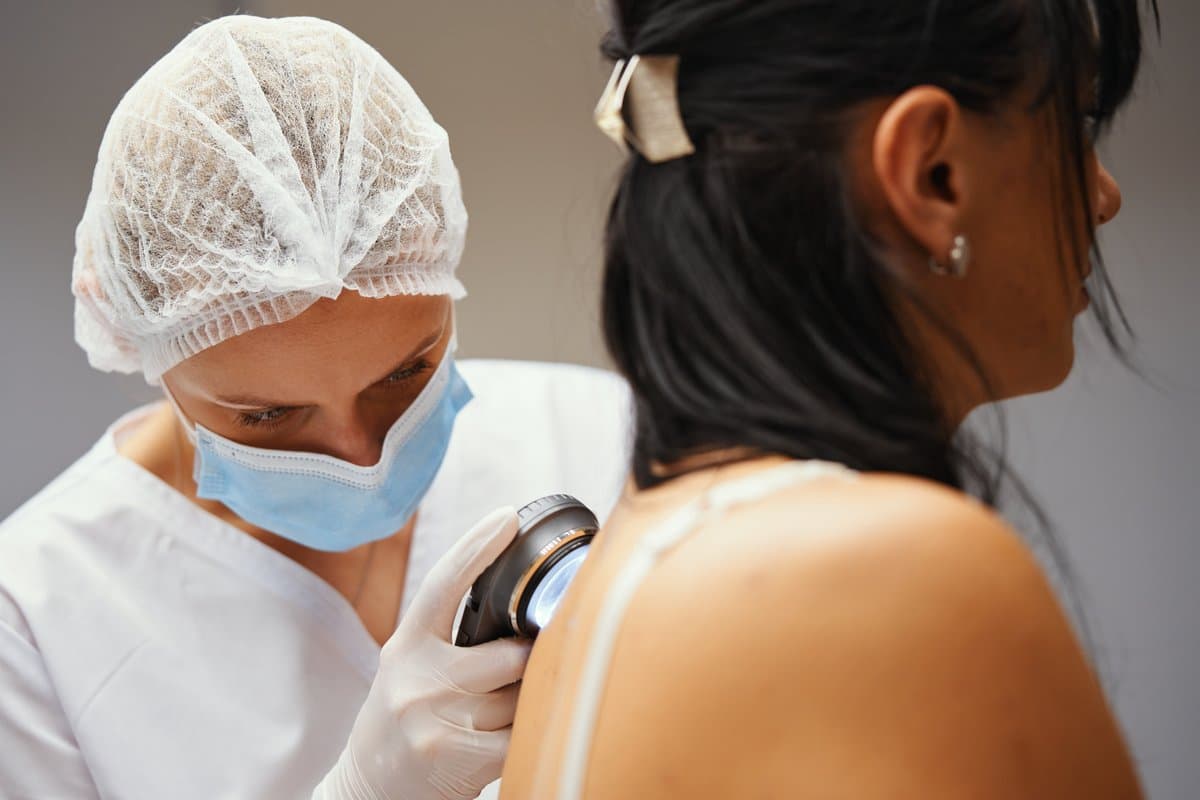 When to See a Doctor and Monitoring Your Skin